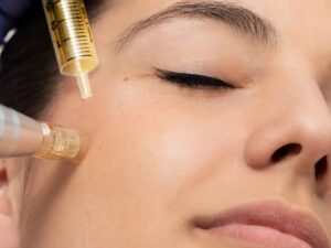 Microagujas-Especialista-en-Induccion-de-Colageno-Lavida-aesthetic-institute-lavidaai-Houston-TX.jpg