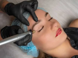 Fibroblast Plasma Lift Certification Training-1.webp